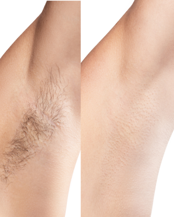 Underarm Wax (15 mins)