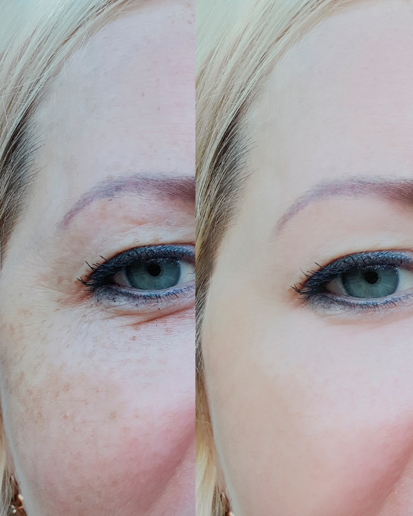 Pigmentation (90 mins)